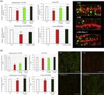 Synaptophysin Antibody in Immunohistochemistry (IHC)