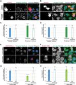 ITGB1 Antibody in Immunocytochemistry (ICC/IF)