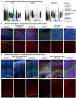 PGK1 Antibody in Immunohistochemistry (IHC)