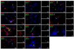 KLF4 Antibody in Immunocytochemistry (ICC/IF)