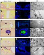 Staphylococcus aureus Antibody in Immunohistochemistry (IHC)