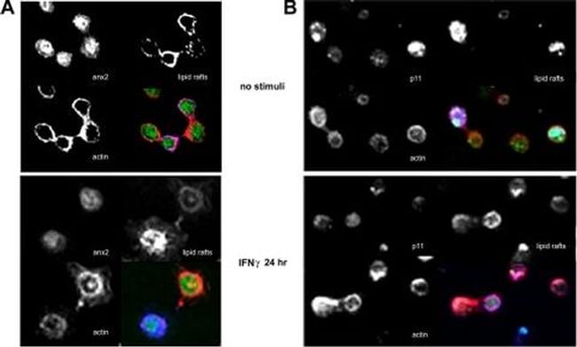 Annexin A2 Antibody in Immunocytochemistry (ICC/IF)