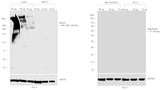 Human Kappa Light Chain Secondary Antibody