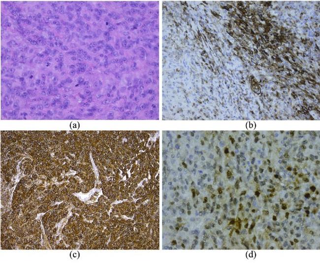 MDM2 Antibody in Immunohistochemistry (IHC)