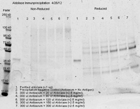 Aldolase Antibody in Immunoprecipitation (IP)
