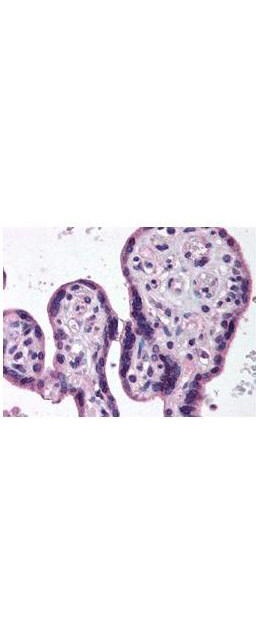 IKK beta Antibody in Immunohistochemistry (Paraffin) (IHC (P))