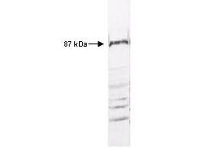 IKK beta Antibody in Western Blot (WB)