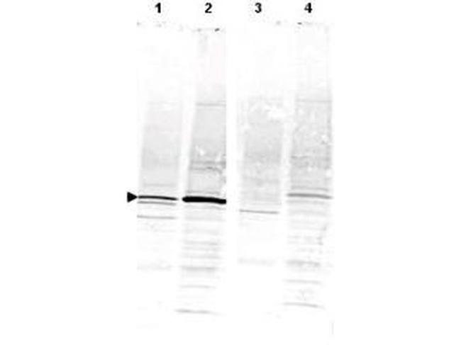 CaM Kinase IV Antibody in Western Blot (WB)