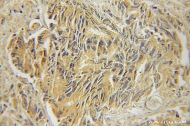 Marcks Antibody in Immunohistochemistry (Paraffin) (IHC (P))