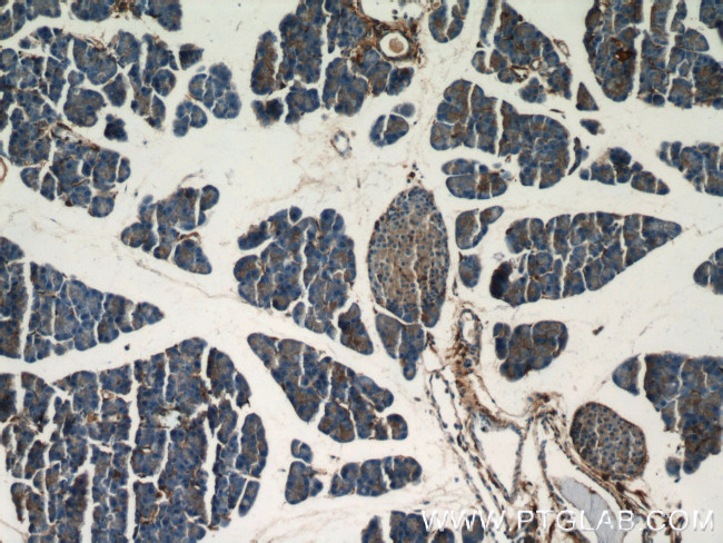 Marcks Antibody in Immunohistochemistry (Paraffin) (IHC (P))