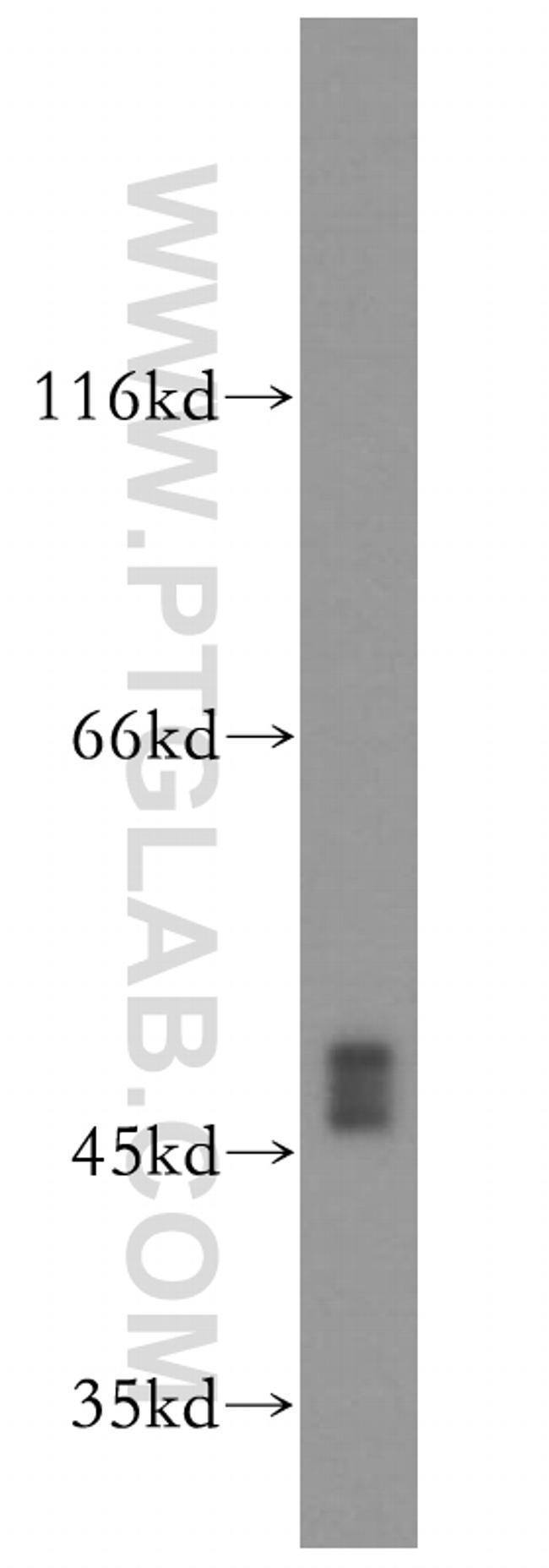 XIAP Antibody in Western Blot (WB)