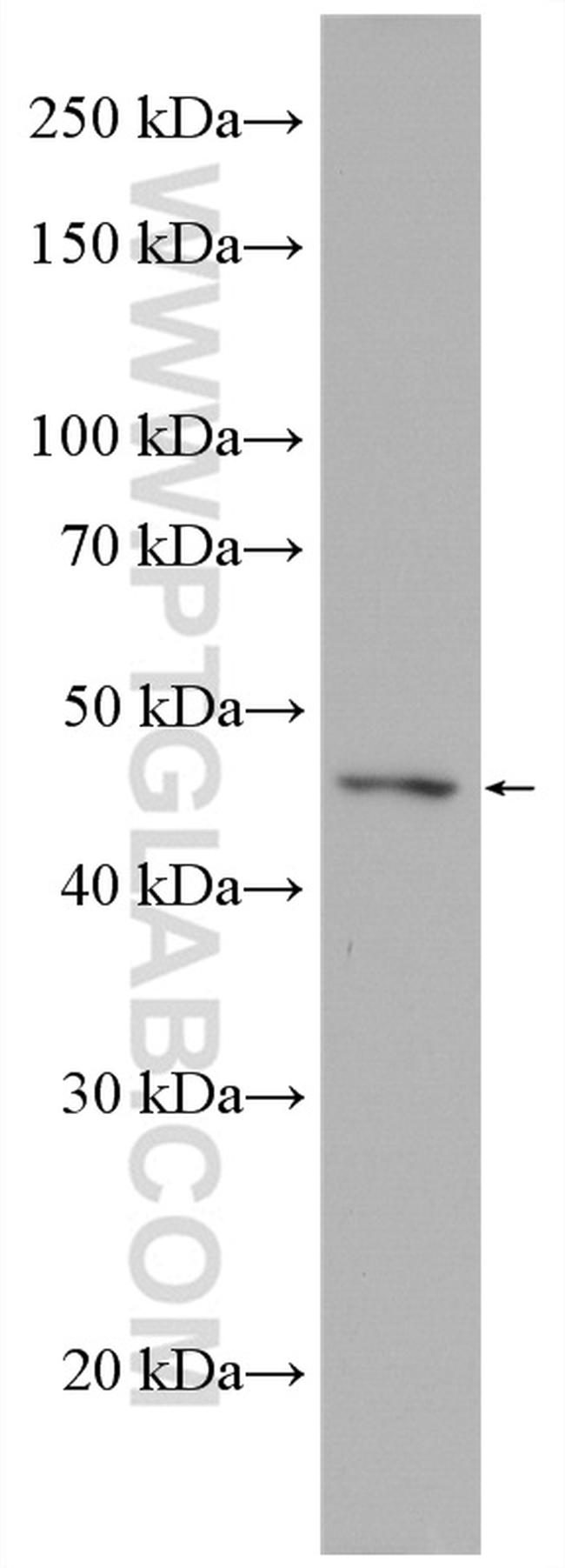 XIAP Antibody in Western Blot (WB)