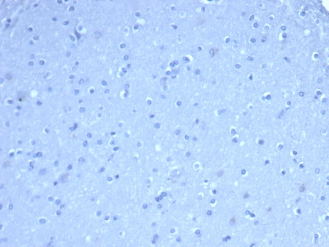 TOM1L1 (Target of Myb1 Like 1 Membrane Trafficking Protein) Antibody in Immunohistochemistry (Paraffin) (IHC (P))