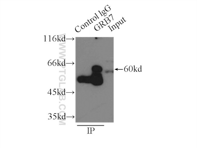 GRB7 Antibody in Immunoprecipitation (IP)