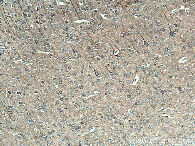 beta Tubulin Antibody in Immunohistochemistry (Paraffin) (IHC (P))