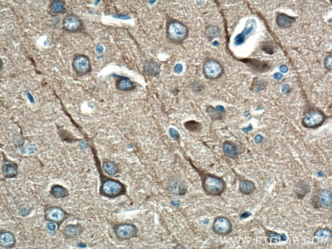 beta Tubulin Antibody in Immunohistochemistry (Paraffin) (IHC (P))