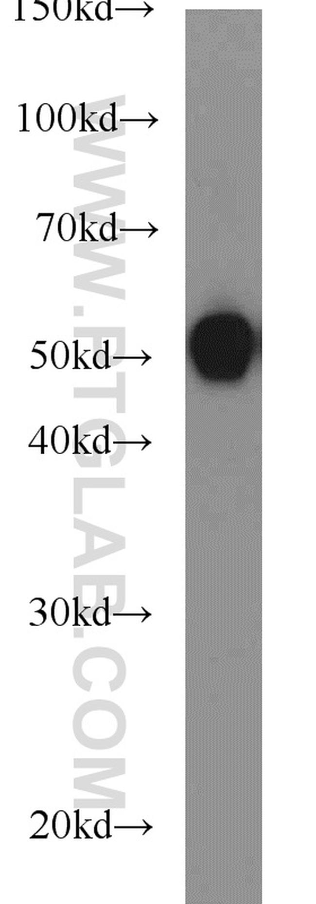 beta Tubulin Antibody in Western Blot (WB)