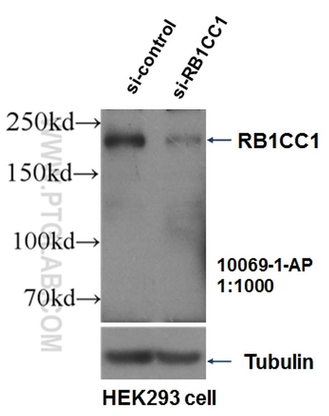 RB1CC1 Antibody in Western Blot (WB)