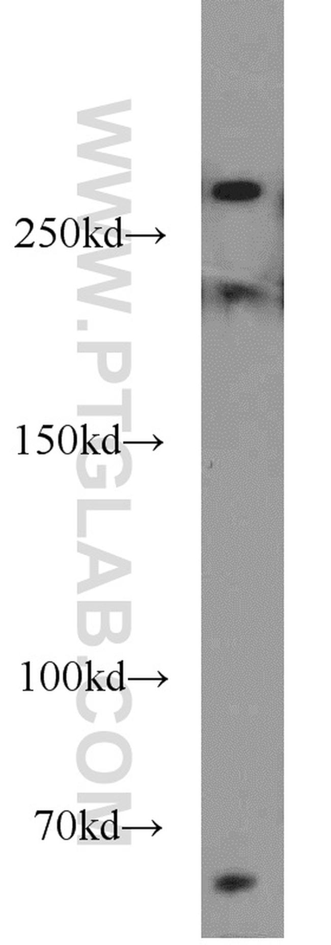 RB1CC1 Antibody in Western Blot (WB)