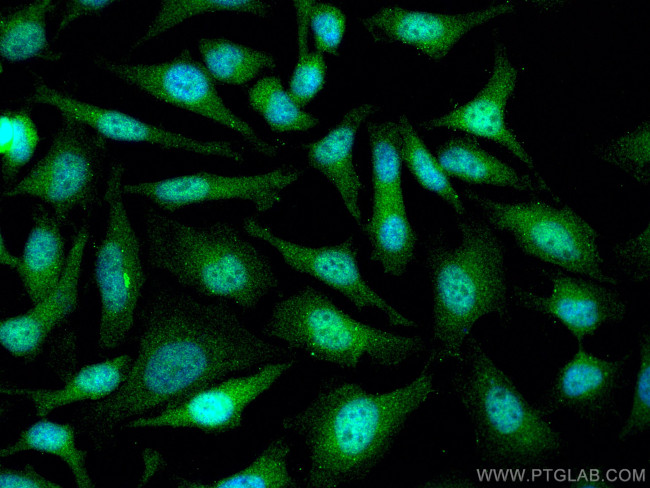 UBC9 Antibody in Immunocytochemistry (ICC/IF)