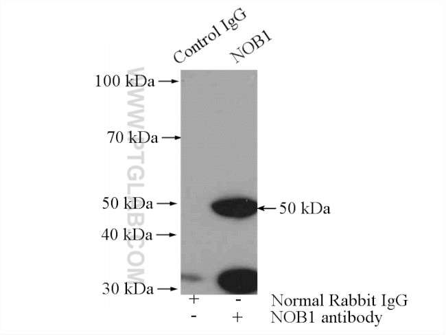 NOB1 Antibody in Immunoprecipitation (IP)