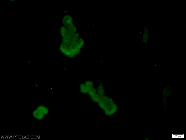 AKAP8L Antibody in Immunocytochemistry (ICC/IF)