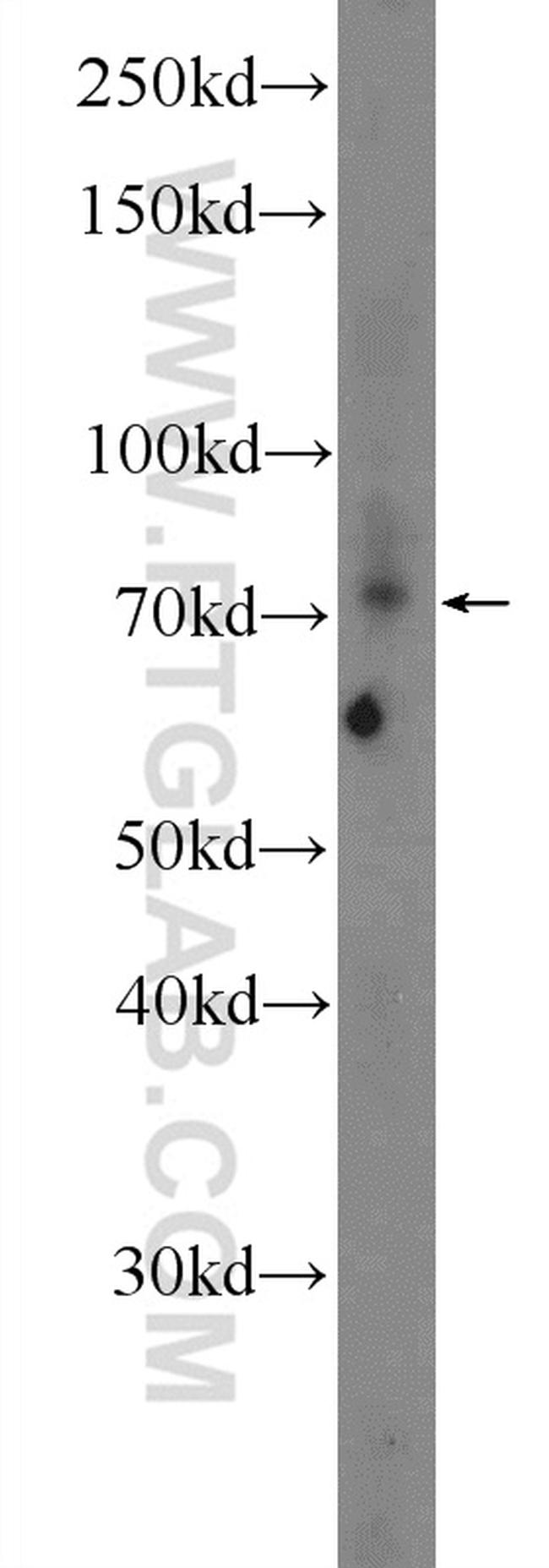 AKAP8L Antibody in Western Blot (WB)