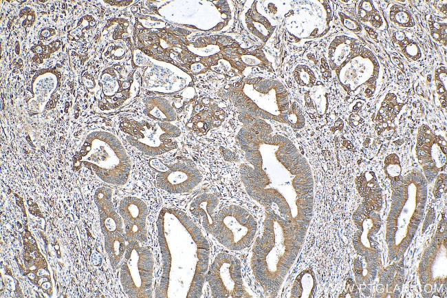 PRC1 Antibody in Immunohistochemistry (Paraffin) (IHC (P))