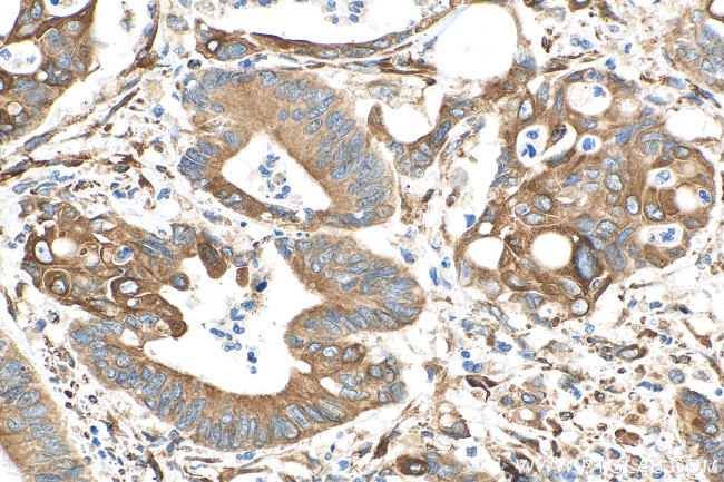 PRC1 Antibody in Immunohistochemistry (Paraffin) (IHC (P))