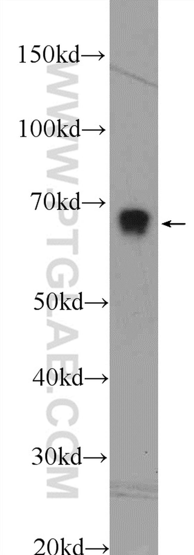 PRC1 Antibody in Western Blot (WB)