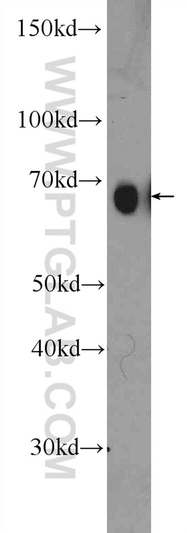 PRC1 Antibody in Western Blot (WB)