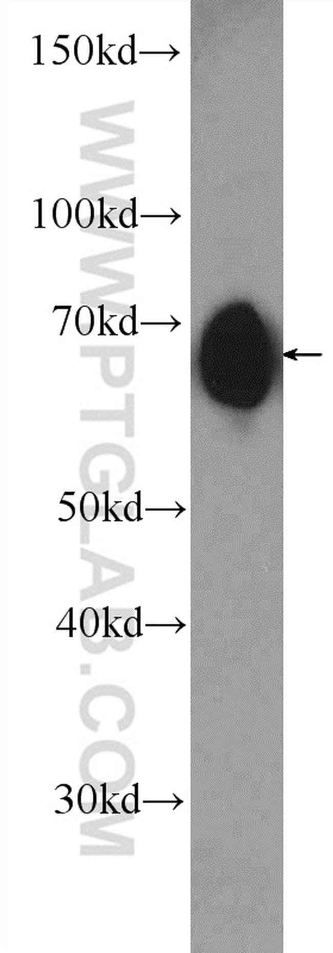 PRC1 Antibody in Western Blot (WB)