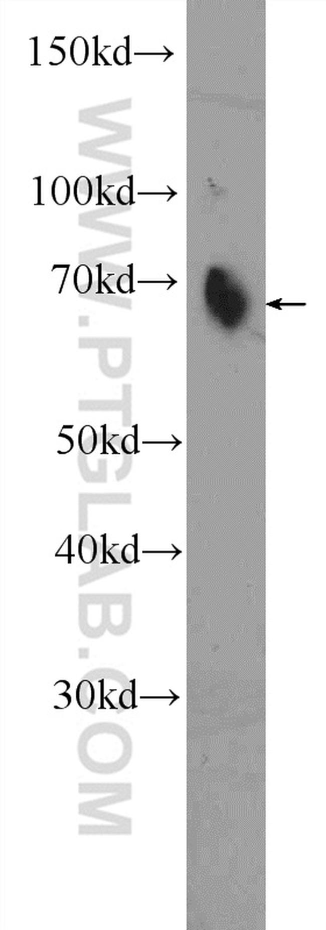 PRC1 Antibody in Western Blot (WB)