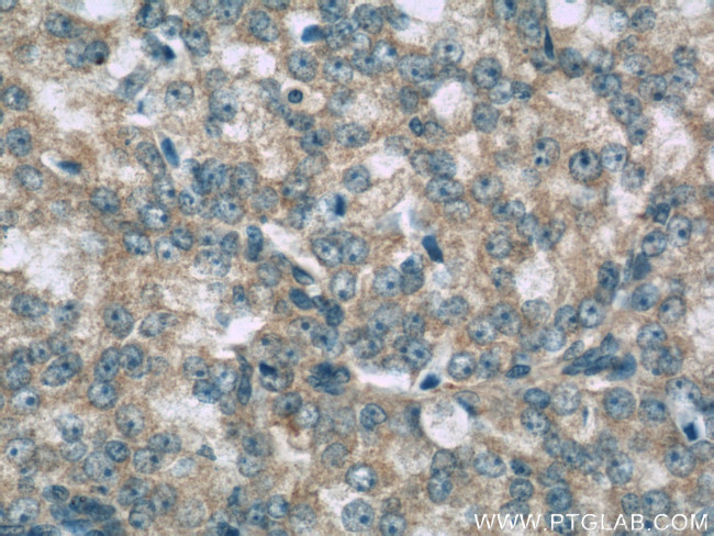 SNX6 Antibody in Immunohistochemistry (Paraffin) (IHC (P))