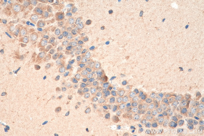 SNX6 Antibody in Immunohistochemistry (Paraffin) (IHC (P))