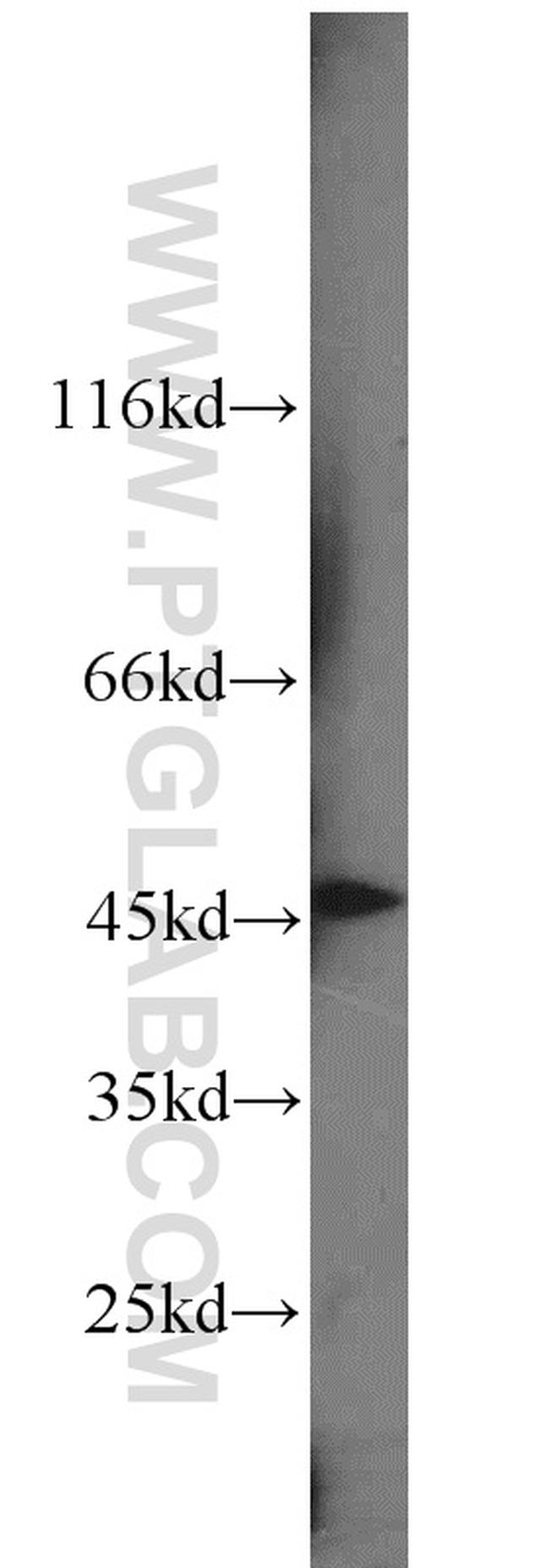 SNX6 Antibody in Western Blot (WB)