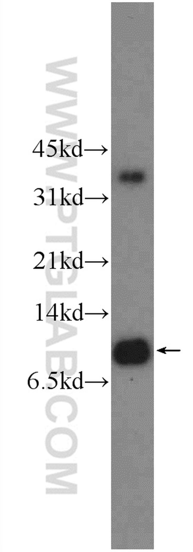 LSM8 Antibody in Western Blot (WB)