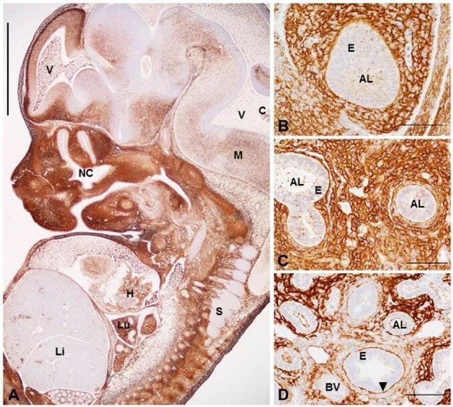 Versican V0, V1 Neo Antibody in Immunohistochemistry (IHC)