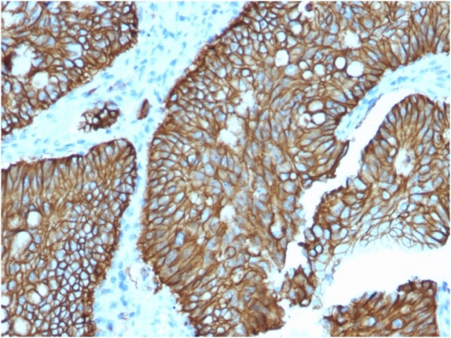 Cadherin 17/LI Cadherin (Liver-Intestine Marker) Antibody in Immunohistochemistry (Paraffin) (IHC (P))
