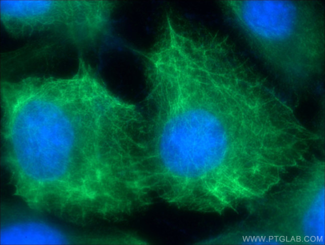 Cytokeratin 13 Antibody in Immunocytochemistry (ICC/IF)