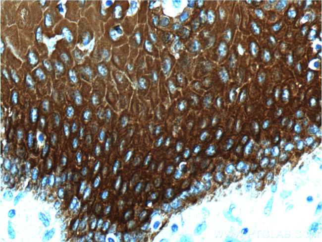 Cytokeratin 13 Antibody in Immunohistochemistry (Paraffin) (IHC (P))