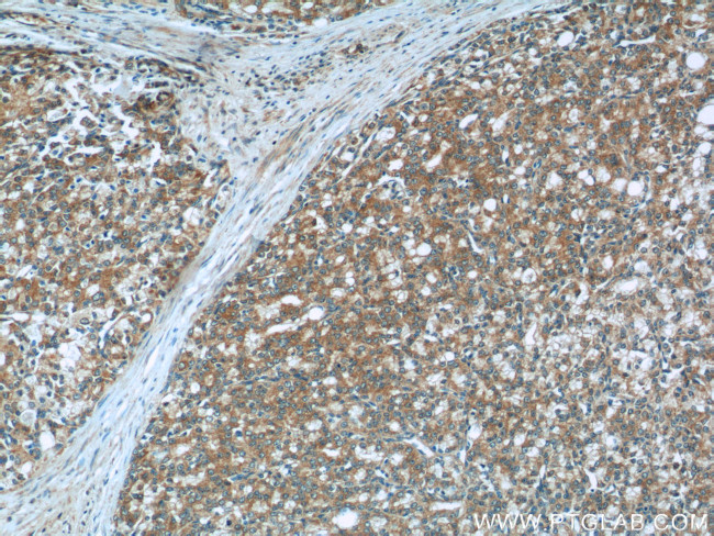 ACSM3 Antibody in Immunohistochemistry (Paraffin) (IHC (P))