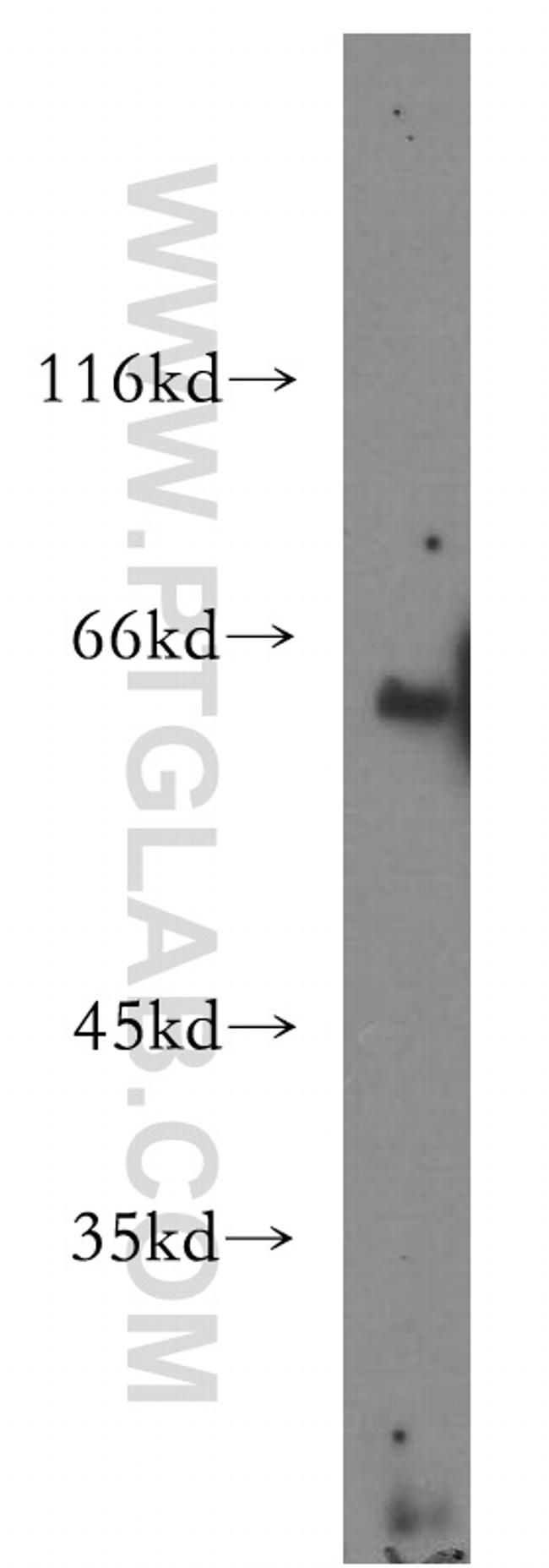 ACSM3 Antibody in Western Blot (WB)