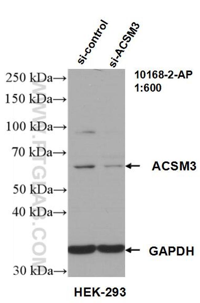 ACSM3 Antibody in Western Blot (WB)