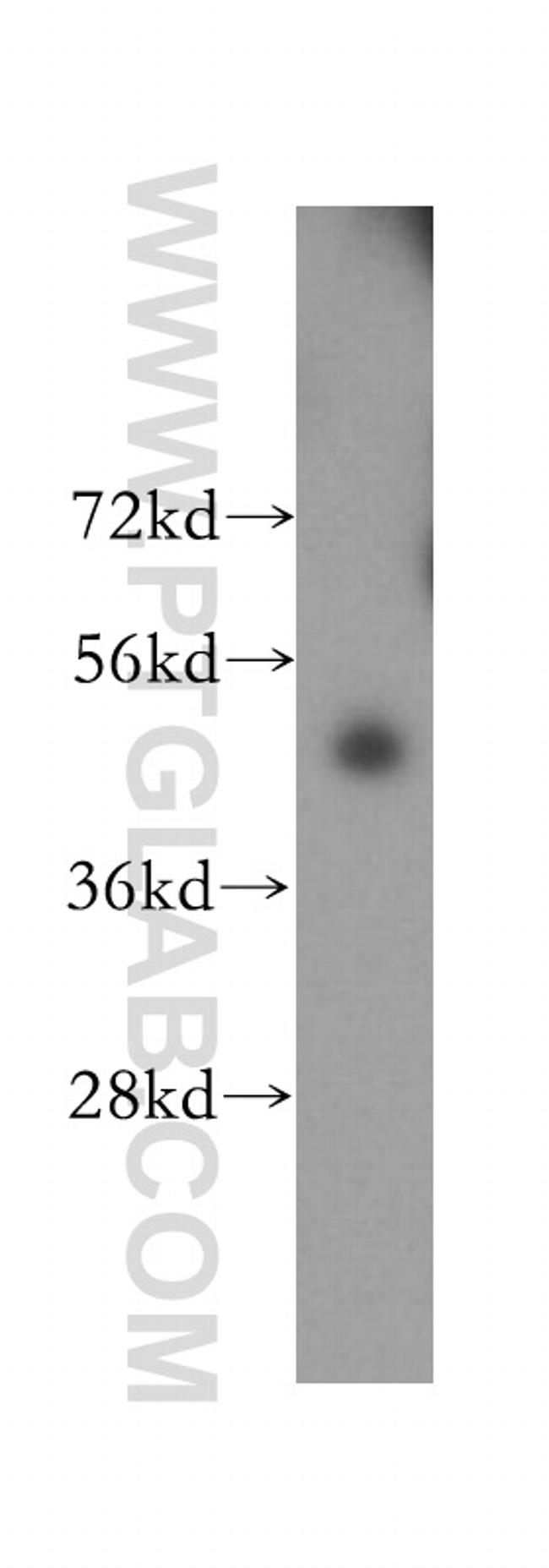 ACSM3 Antibody in Western Blot (WB)