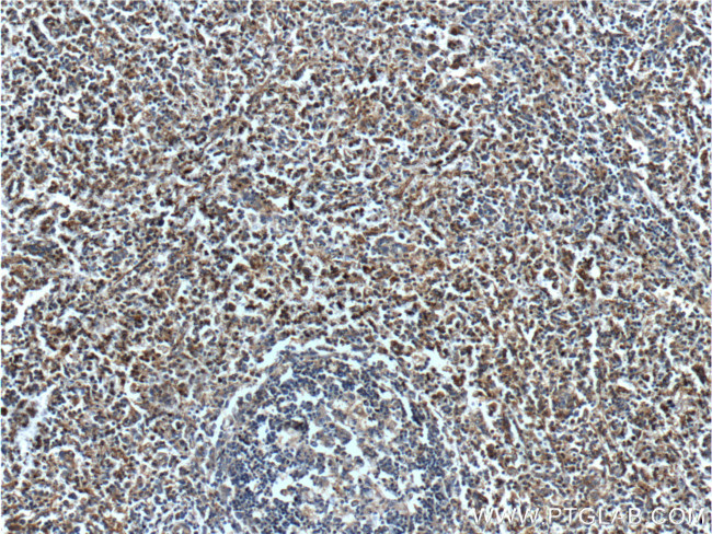 Beta Arrestin 2 Antibody in Immunohistochemistry (Paraffin) (IHC (P))