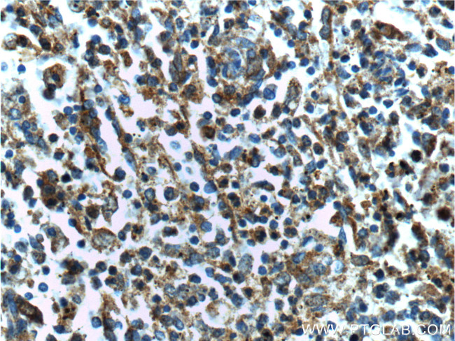 Beta Arrestin 2 Antibody in Immunohistochemistry (Paraffin) (IHC (P))