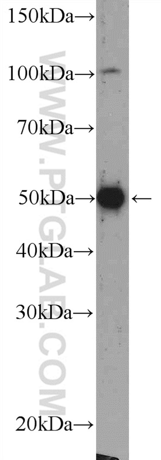 Beta Arrestin 2 Antibody in Western Blot (WB)