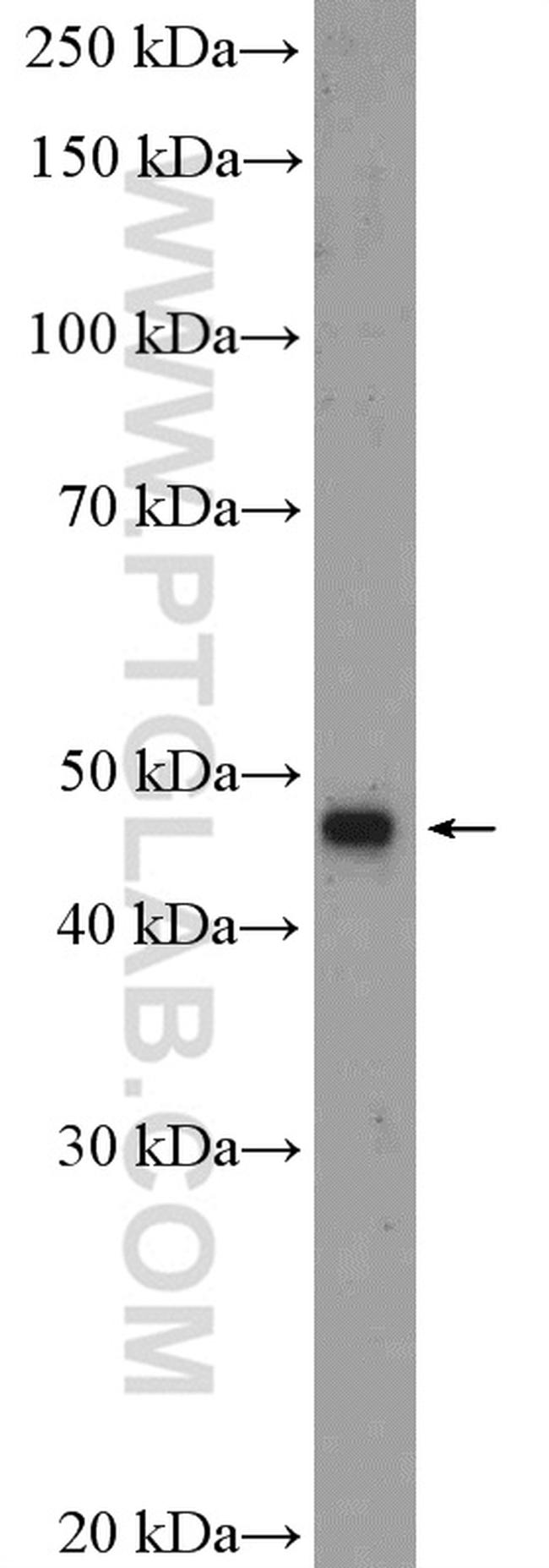 Beta Arrestin 2 Antibody in Western Blot (WB)