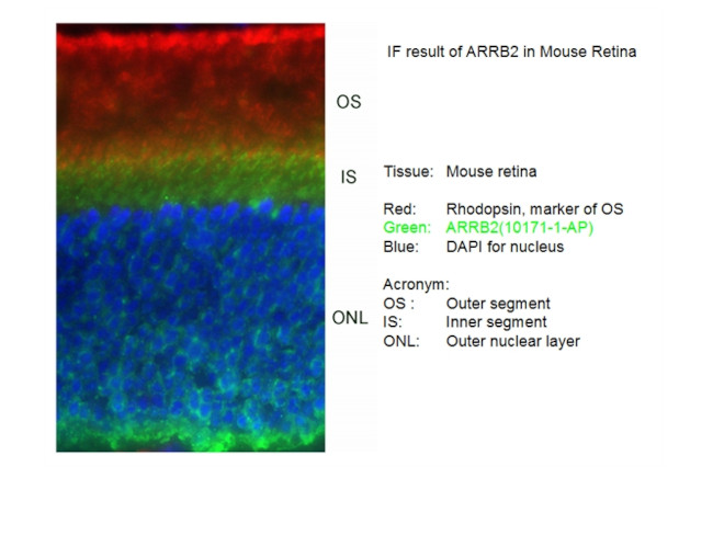 Beta Arrestin 2 Antibody in Immunohistochemistry (IHC)